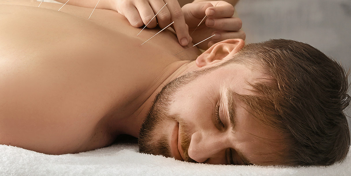 acupuncture thin needles